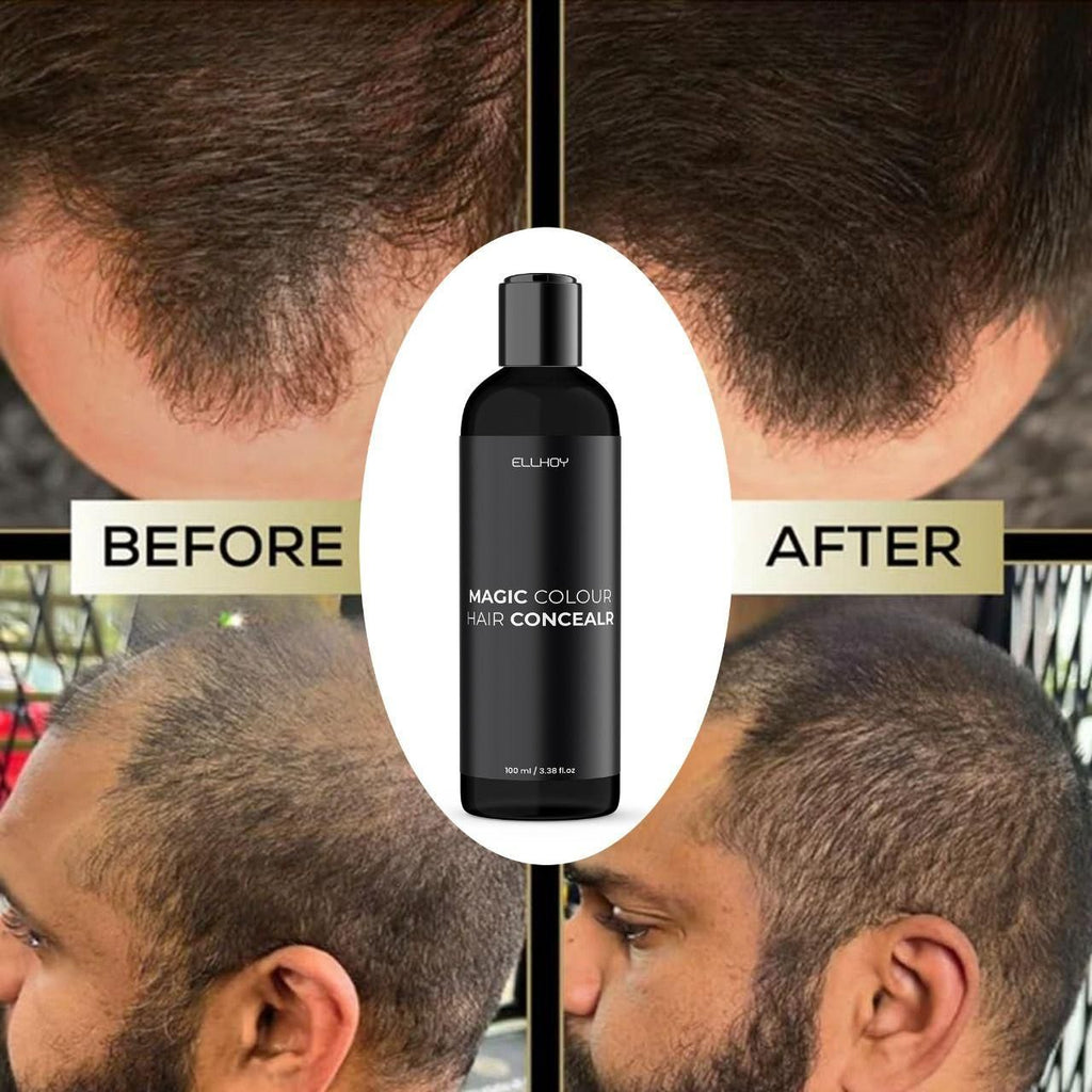ELLHOY Magic Colour Hair Concealer Spray for Women & Men (100ml, Pack of 2) | Instant Root Touch-Up Spray | Covers Gray Hair Instantly